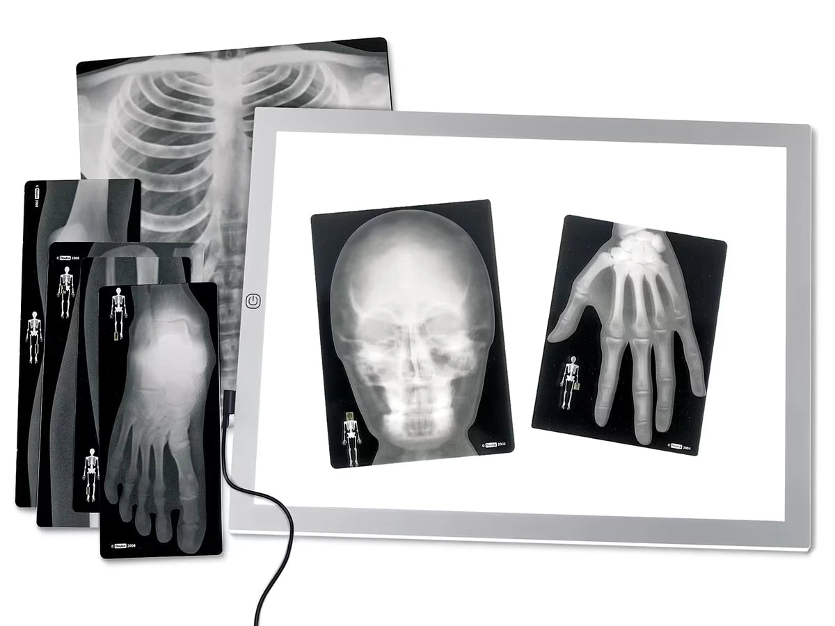Human X-Rays - Set of 18 - US 2012