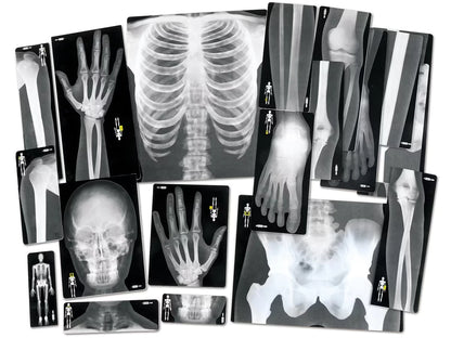 Human X-Rays - Set of 18 - US 2012