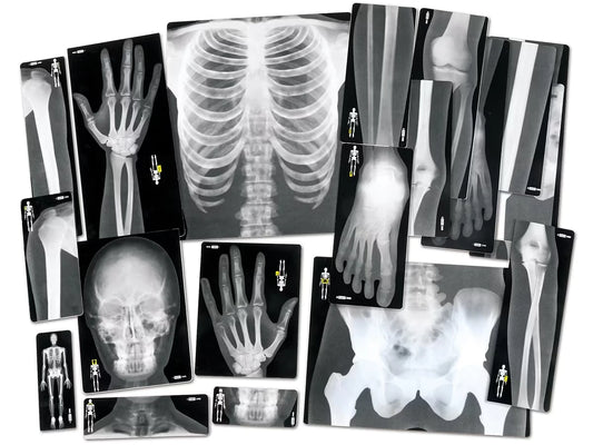 Human X-Rays - Set of 18 - US 2012